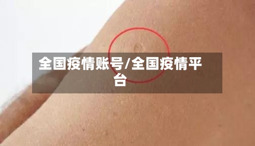 全国疫情账号/全国疫情平台-第2张图片