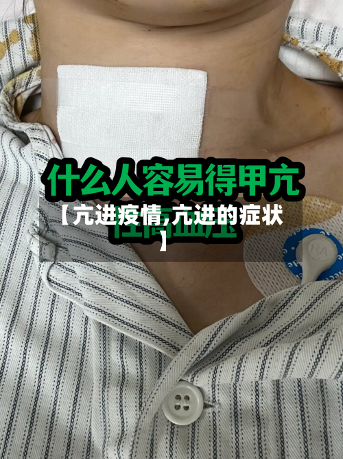 【亢进疫情,亢进的症状】-第3张图片