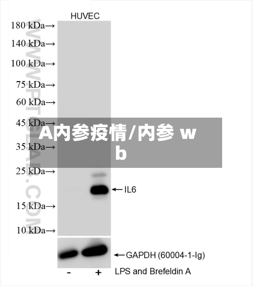 A内参疫情/内参 wb-第2张图片