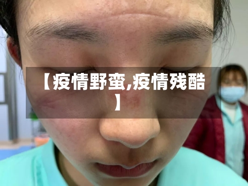 【疫情野蛮,疫情残酷】-第2张图片