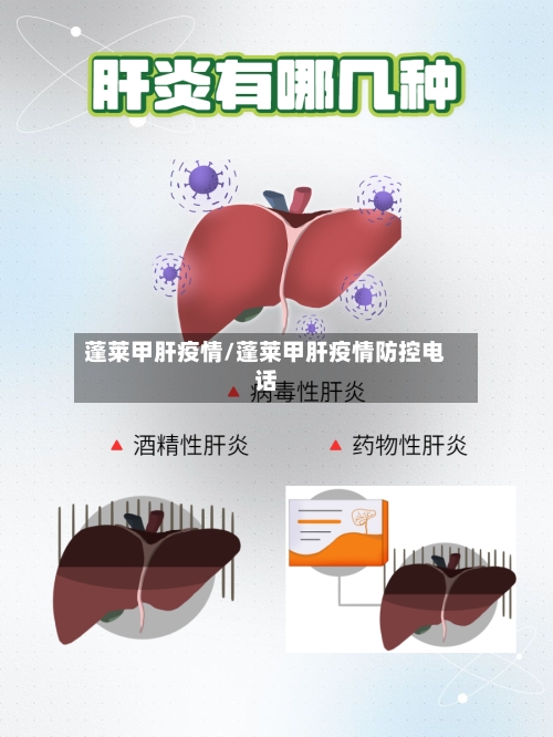 蓬莱甲肝疫情/蓬莱甲肝疫情防控电话